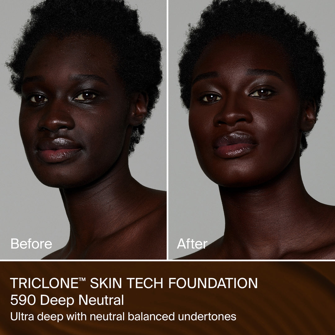 TRICLONE™ SKIN TECH MEDIUM COVERAGE FOUNDATION